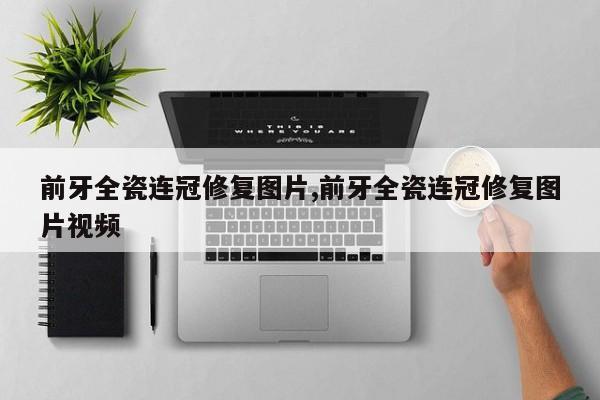 前牙全瓷连冠修复图片,前牙全瓷连冠修复图片视频